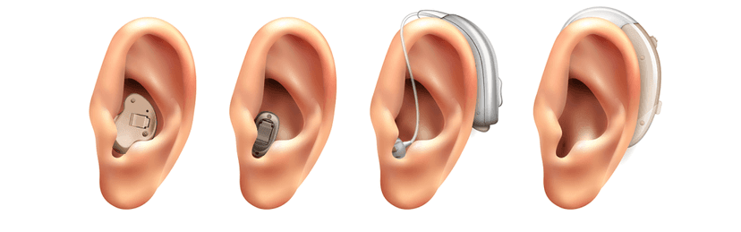 Compare hearing aid prices in India